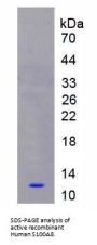 Human Protein S100-A8 / CAGA (S100A8) Protein (Active)