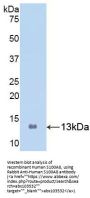 Human Protein S100-A8 / CAGA (S100A8) Protein (Active)