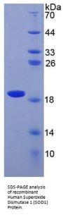 Human Superoxide Dismutase 1 (SOD1) Protein (Active)