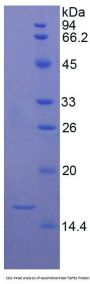 Rat Transforming Growth Factor Beta 1 (TGFb1) Protein (Active)