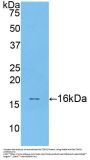 Rat Transforming Growth Factor Beta 1 (TGFb1) Protein (Active)