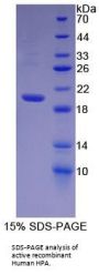 Human Heparanase (HPA) Protein (Active)