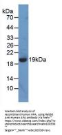 Human Heparanase (HPA) Protein (Active)