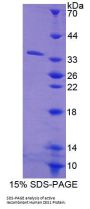 Human Carboxylesterase 1 (CES1) Protein (Active)