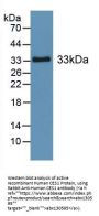 Human Carboxylesterase 1 (CES1) Protein (Active)