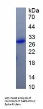 SARS-CoV-2 Spike Protein