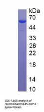 SARS-CoV-2 Spike Protein