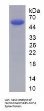 SARS-CoV-2 Spike Protein