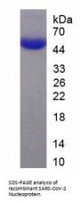 SARS-CoV-2 Nucleoprotein
