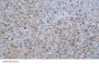 HBsAg Antibody