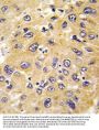 Beta-actin Antibody (Ascites)