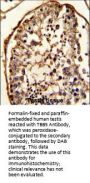 TBB5 Antibody