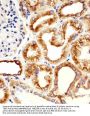 TBB5 Antibody