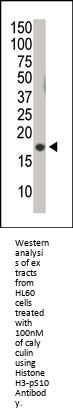 Phospho-Histone H3(S10) Antibody