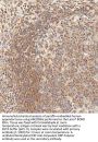 EPCAM Antibody