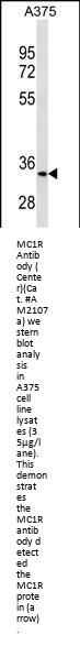 MC1R Antibody (Center)