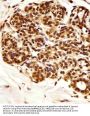 PIN1 Antibody