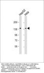RBM6 Antibody