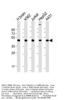 TSG101 Antibody