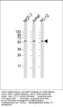 AKT2 Antibody