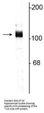 Anti-Amyloid Precursor Protein Antibody