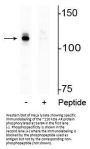 Anti-Androgen Receptor (Ser94) Antibody
