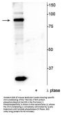 Anti-ATRIP (Ser239) Antibody
