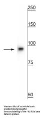 Anti-beta Catenin Antibody