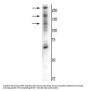 Anti-CaSR Antibody