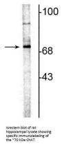 Anti-ChAT (Choline Acetyltransferase) Antibody