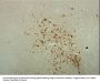 Anti-ChAT (Choline Acetyltransferase) Antibody