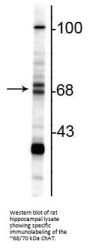 Anti-ChAT (Choline Acetyltransferase) Antibody
