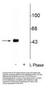 Anti-CREB (Ser133) Antibody