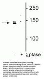 Anti-DENND3 (Ser554) Antibody