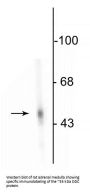 Anti-DOPA Decarboxylase Antibody