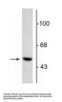 Anti-DOPA Decarboxylase Antibody