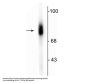 Anti-Dopamine ß-Hydroxylase, C-Terminus Antibody