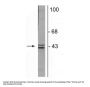 Anti-Doublecortin Antibody