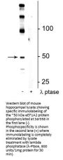 Anti-eEF1A2 (Ser358) Antibody