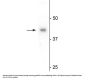 Anti-eIF4A2 Antibody
