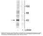 Anti-EphrinB (Tyr298) Antibody