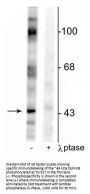 Anti-EphrinB (Tyr317) Antibody