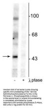 Anti-EphrinB (Tyr331) Antibody