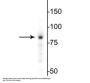 Anti-EWS Antibody