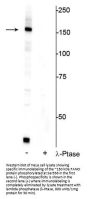 Anti-FANCI (Ser556) Antibody