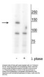 Anti-FANCI (Ser559) Antibody