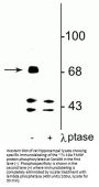 Anti-FMRP (Ser499) Antibody