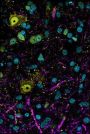Anti-FMRP (Ser499) Antibody