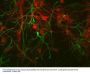 Anti-Glial Fibrillary Acidic Protein (GFAP) Antibody