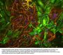Anti-Glial Fibrillary Acidic Protein (GFAP) Antibody
